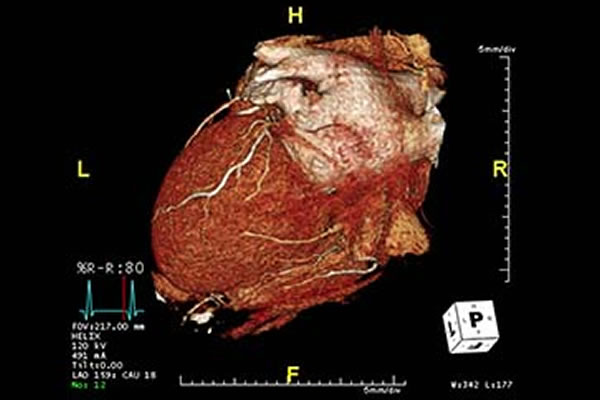 Picture of heart scan