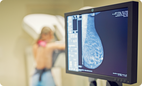 Picture of a mammogram screen