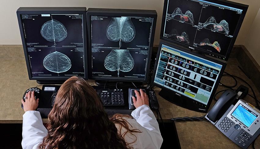3d mammogram software images